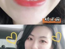 小姐姐矫正下巴视频教程,小姐姐亲授下巴矫正技巧全解析